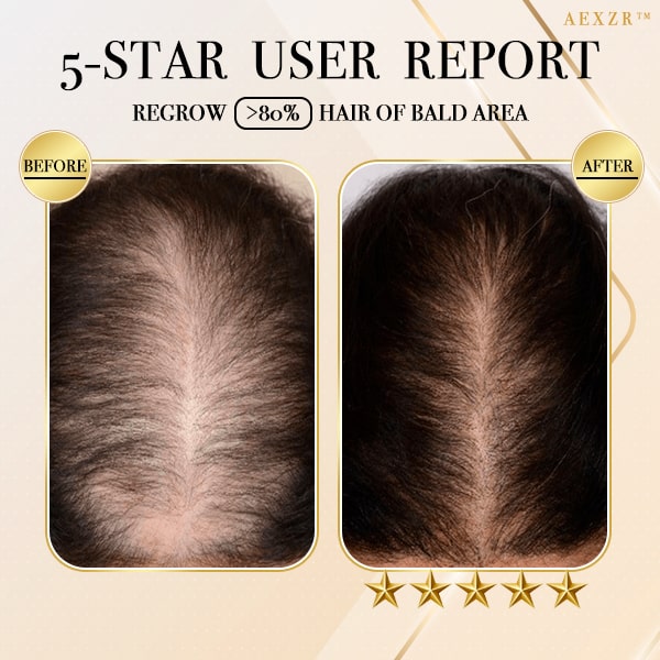 Aexzr™ Ginger Hair Regrowth Shampoo Bar